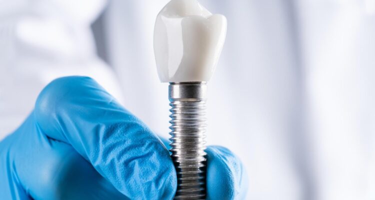 Ankara Yenimahalle diş implantı fiyatları 2026 – titanyum implant vida ve kuron