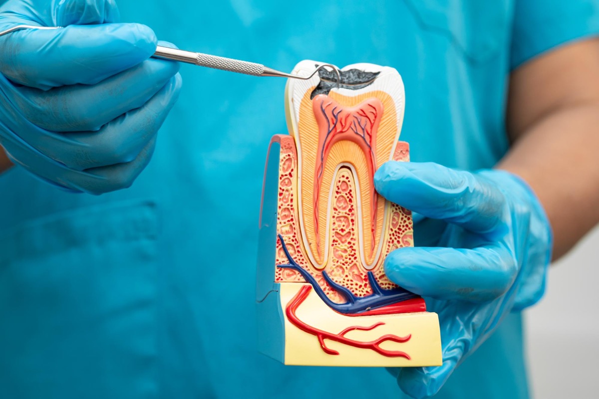 Kanal tedavisi diş kesiti anatomisi | Ankara endodonti kliniği